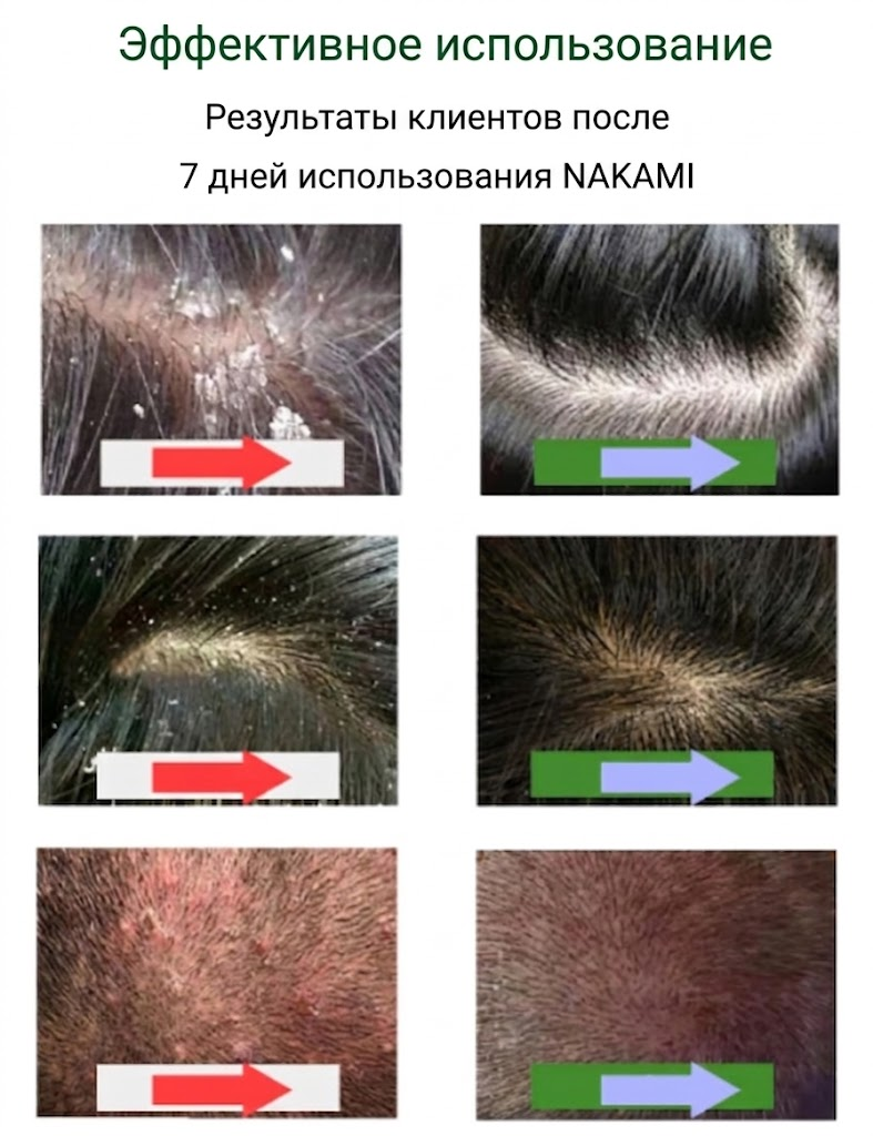 Результат применения Nakami Shampoo